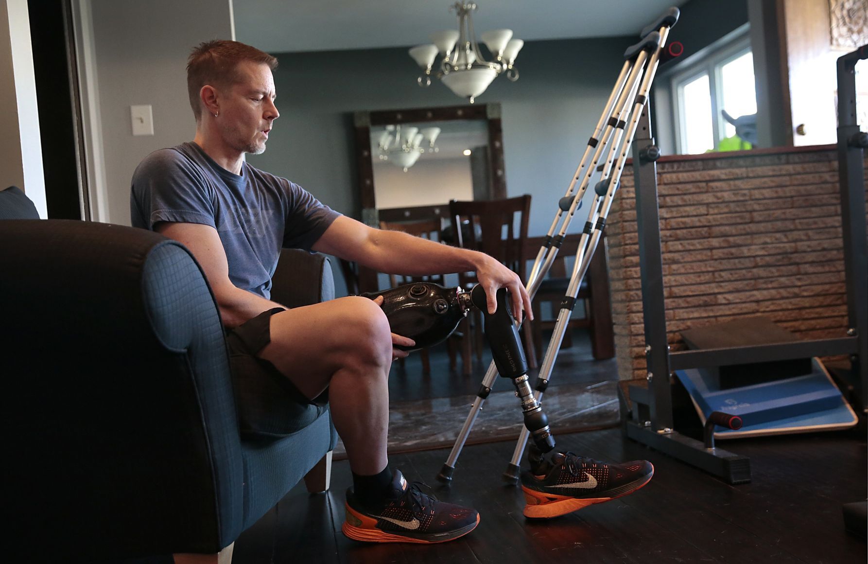 Champion cyclist chooses amputation following skateboarding accident